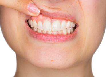 Periodontoloji